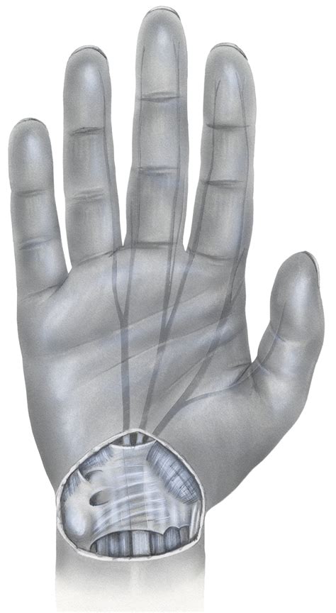 possible injuries in playing card games|Common Hand Injuries in Gamers .